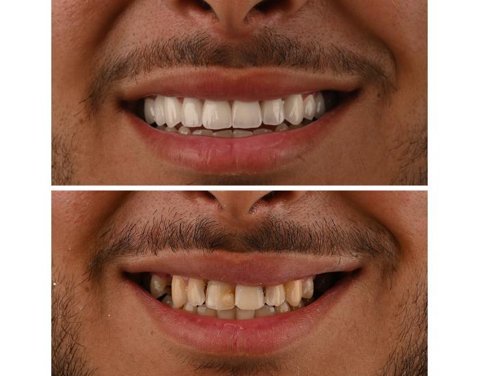 Centre Dentaire Kandil à Mohammedia – Implants dentaires & soins complets